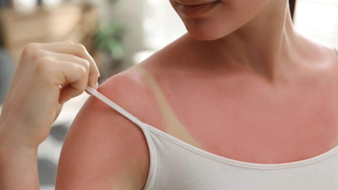 Skin Cancer Screening and Mole Evaluations in Arlington, VA